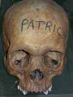 The Skull of a Rwandan Genocide Victim